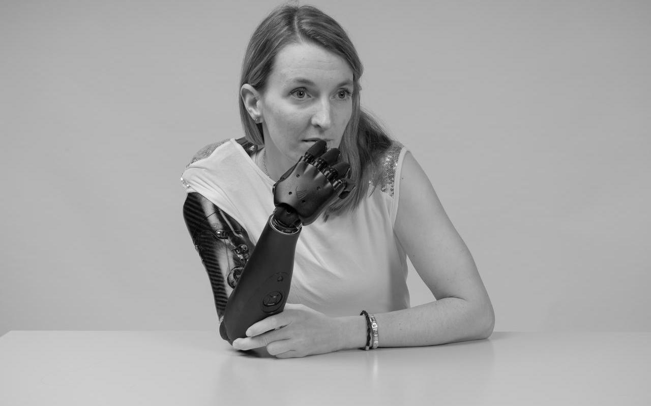 Dynamic Arm, portet uit de fotoserie Medical engineering van Aristidis Schnelzer. Dynamic Arm, portet uit de fotoserie Medical engineering van Aristidis Schnelzer.