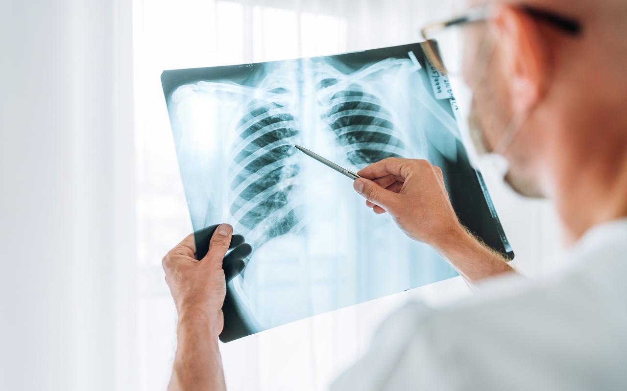 Een dokter kijkt naar een longfoto om te kijken of iemand tbc heeft. Een dokter kijkt naar een longfoto om te kijken of iemand tbc heeft.