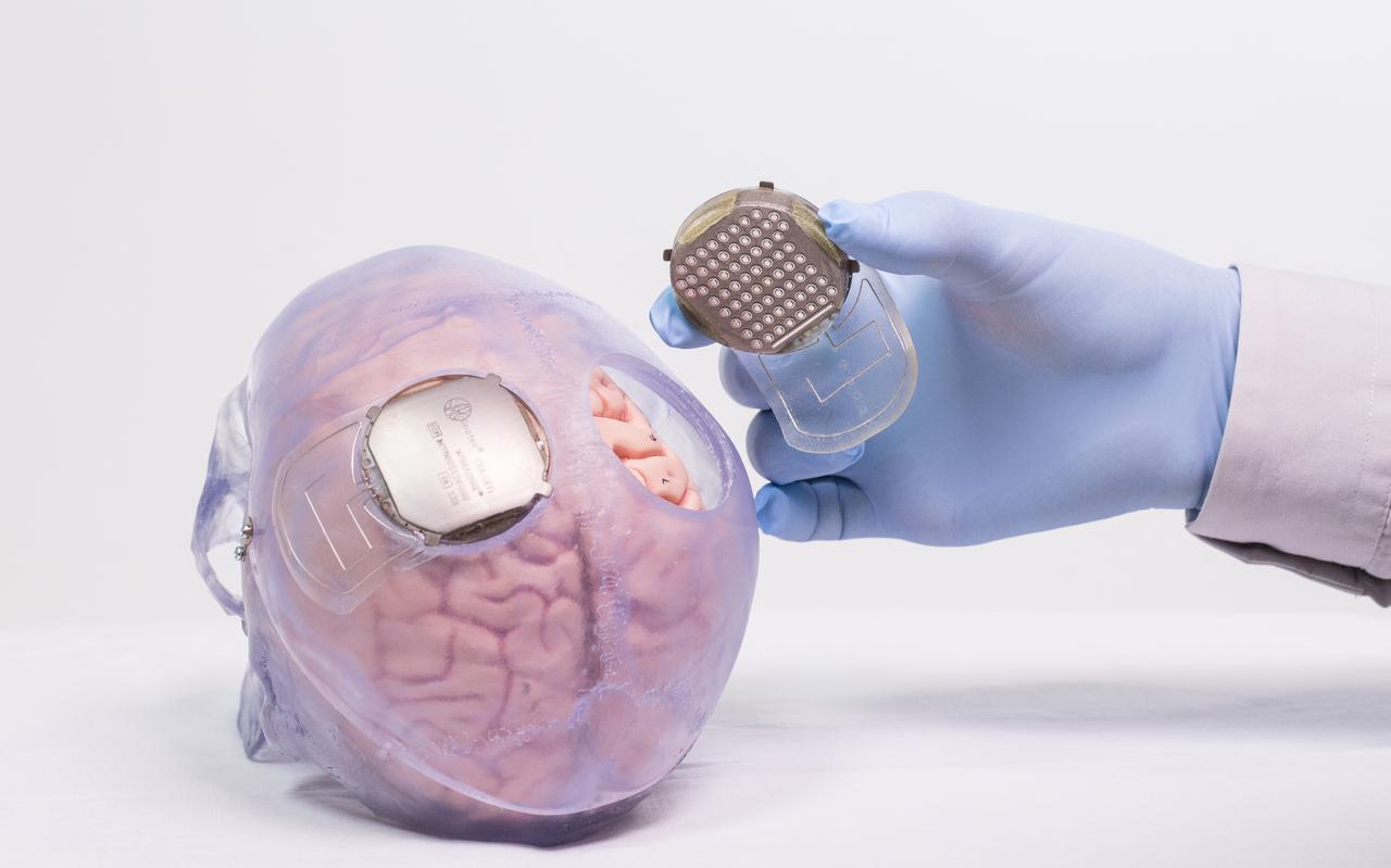 Een Franse wetenschapper houdt een hersenimplantaat vast. 