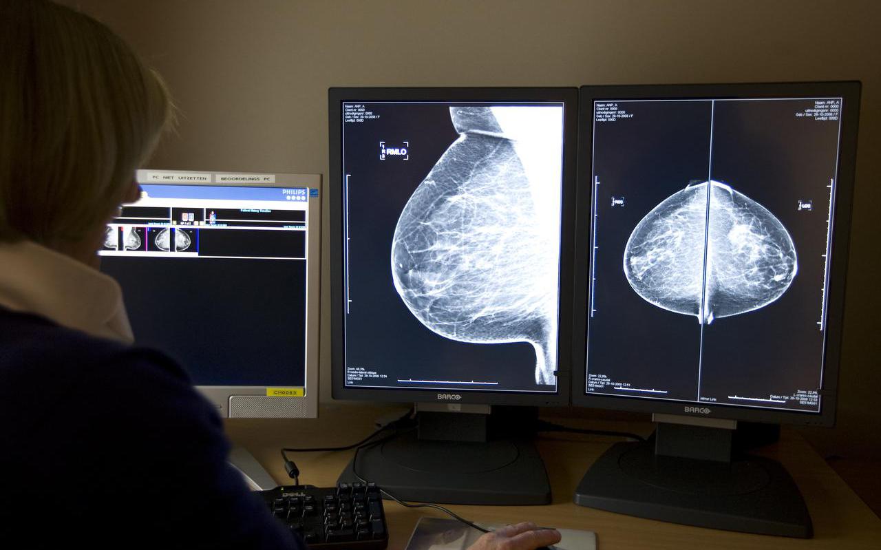 Het bevolkingsonderzoek naar borstkanker heeft vertraging opgelopen, die voorlopig niet kan worden ingehaald.